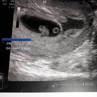 Metodo Ramzi! Chi ci sa azzeccare? - 1