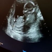 Future mamme Aprile 2022 - 1