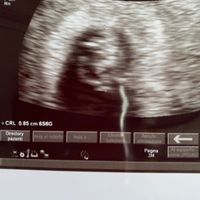 Metodo ramzi chi ne capisce?? - 1