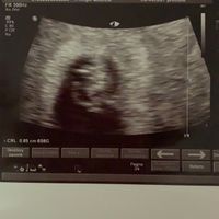 Giochiamo!! Esperte metodo ramai fatevi avanti! - 1