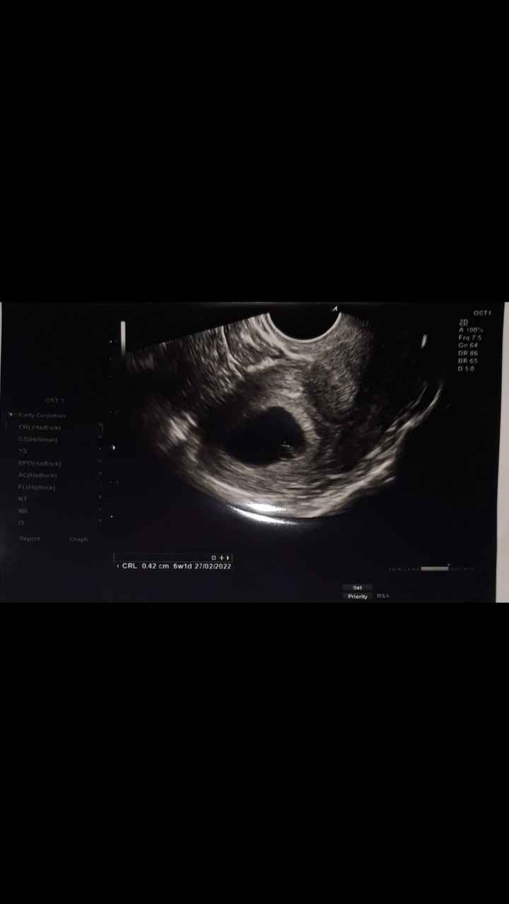 Giochiamo.. Esperte di metodo Ramzi? - 1