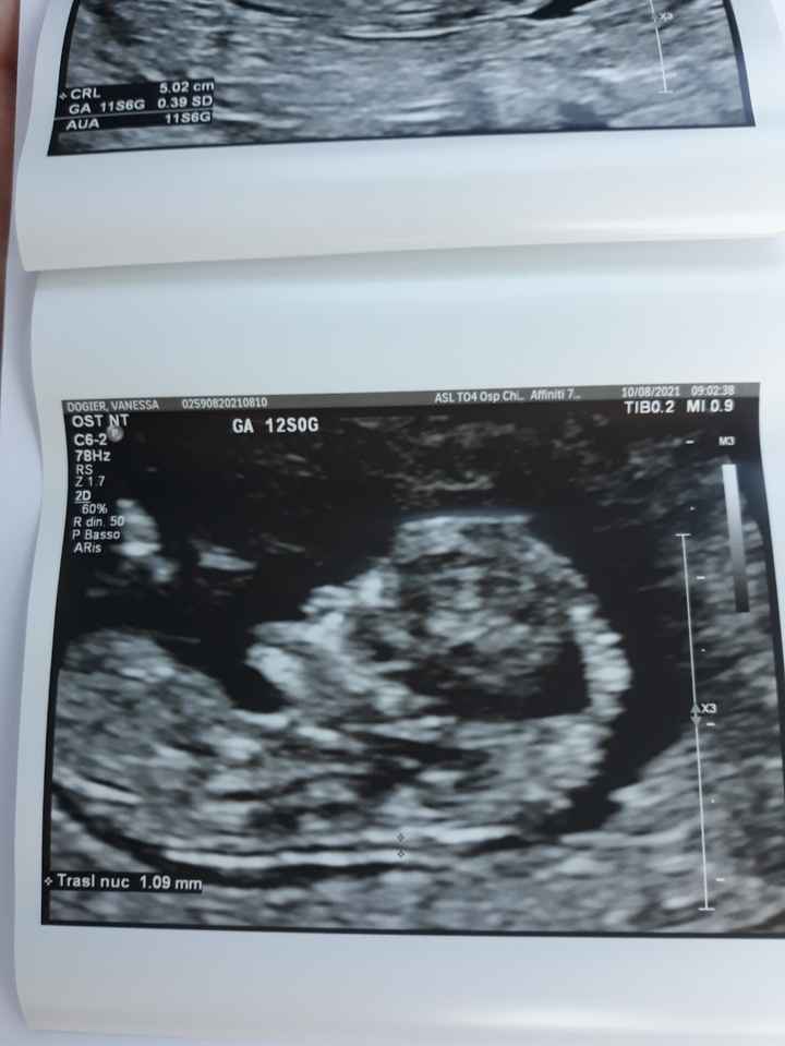 Nub theory. Maschio o femmina?💙🎀 - 2