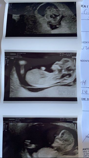 Future mamme Agosto 2021! - 1