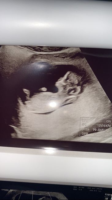 Future mamme Agosto 2021! - 1