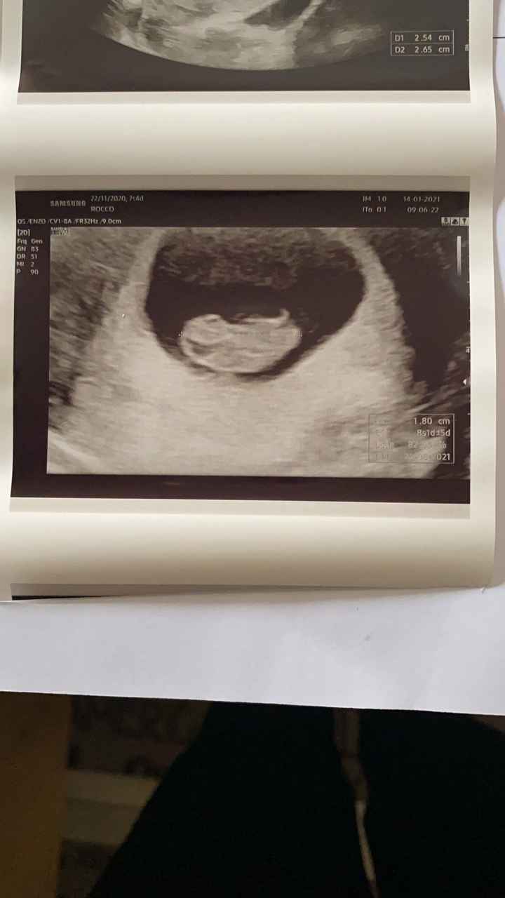 Temperatura basale nel pm. Aiuto. - 1