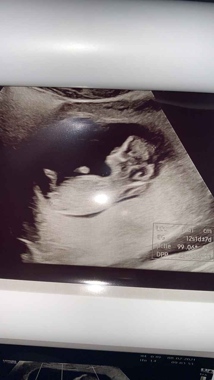 Future mamme Agosto 2021! - 1