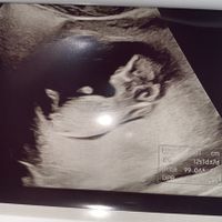 Future mamme Agosto 2021! - 1