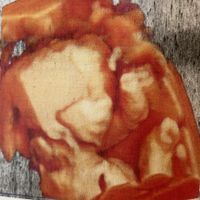 Future mamme Agosto 2021! - 1