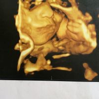 Future mamme Agosto 2021! - 1