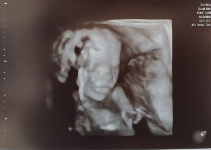 Future mamme Agosto 2021! 1