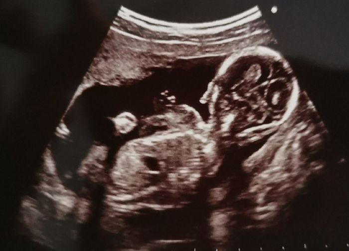Future mamme "dicembrine" 2019 💙💗 6