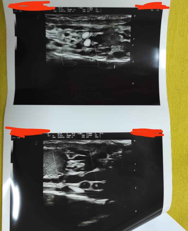 Secondo voi c'è varicocele? - 1