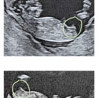 Nub theory, giochiamo un po’ - 1