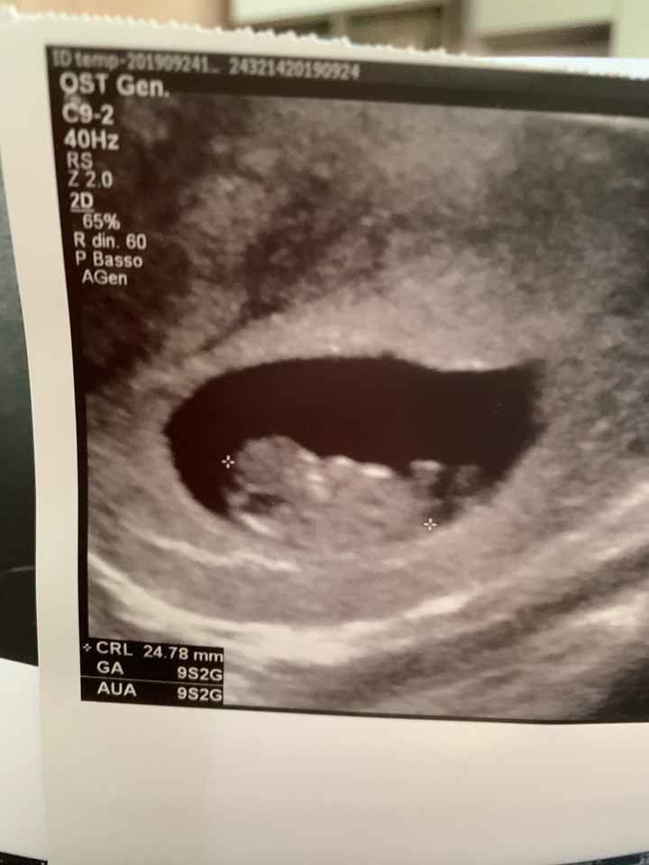 Metodo Ramzi eco 10+1 - 1