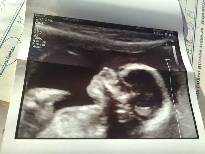 Pre morfologica ok - 1