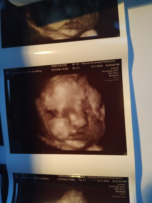 Future mamme "dicembrine" 2019 💙💗 - 1