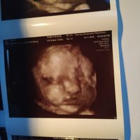 Future mamme "dicembrine" 2019 💙💗 - 1