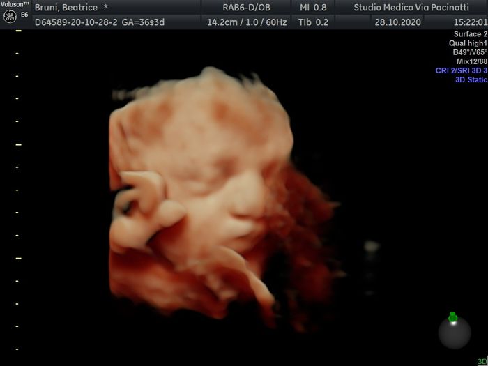 Future mamme novembre 2020 🌞🍁🌷♾ - 1