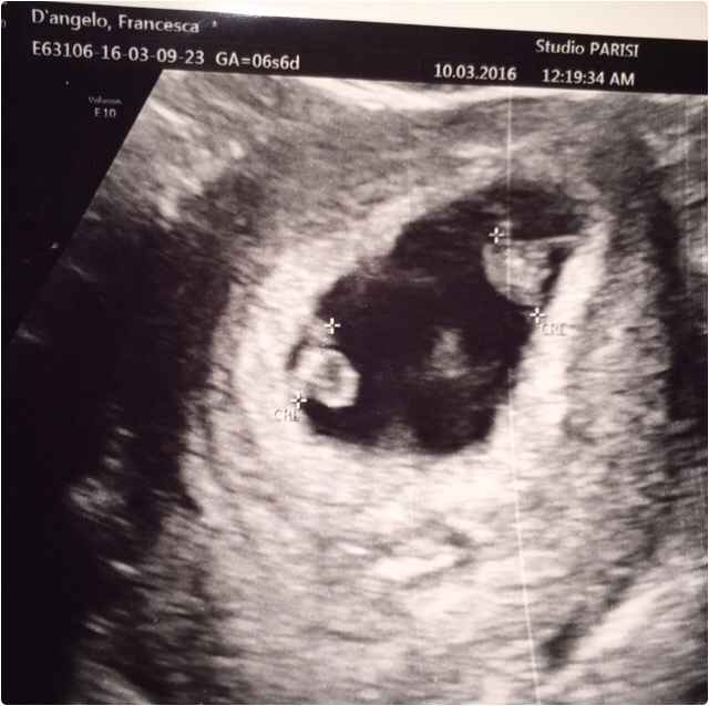 8 mesi dopo il si... - 4