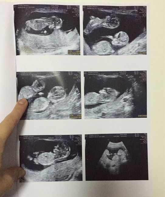 8 mesi dopo il si... - 6