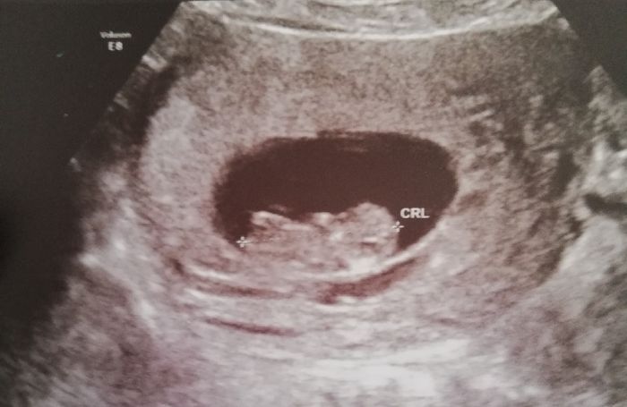 Future mamme novembre 2020 🌞🍁🌷♾ - 1