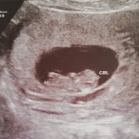 Future mamme novembre 2020 🌞🍁🌷♾ - 1