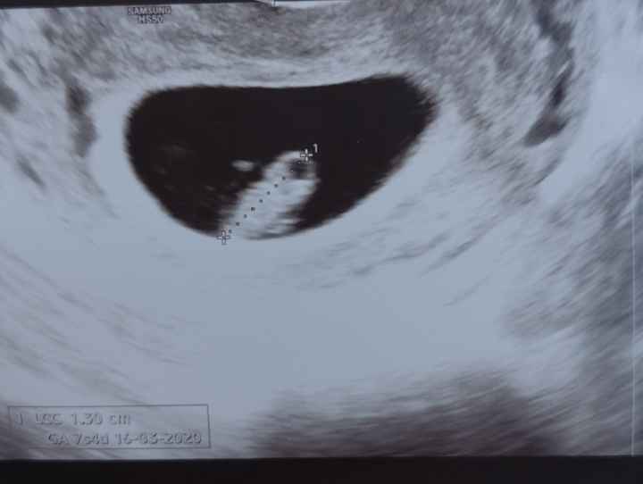 Metodo Ramzi pareri 7