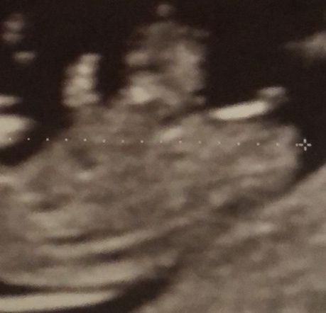 Qualcuno mi può aiutare secondo la teoria nub se sembra ...