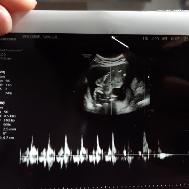 Future Mamme Maggio 2021❤️ - 1