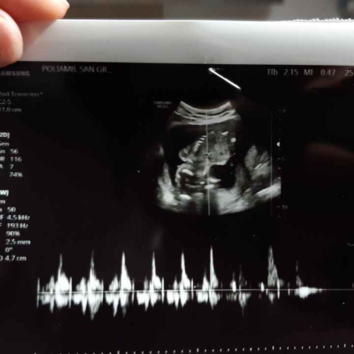 Future Mamme Maggio 2021❤️ - 1