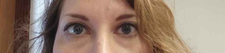 Consiglio contro occhiaie? - 1