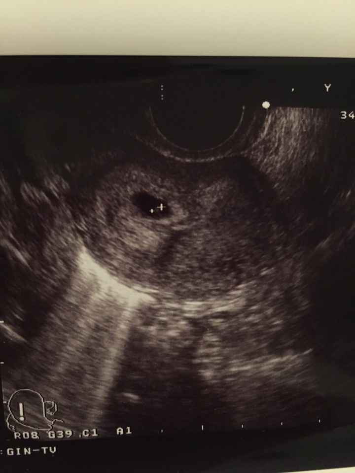 Felicità assoluta - 1