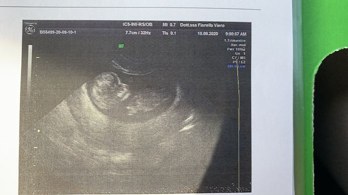 Future mamme Marzo 2021 5