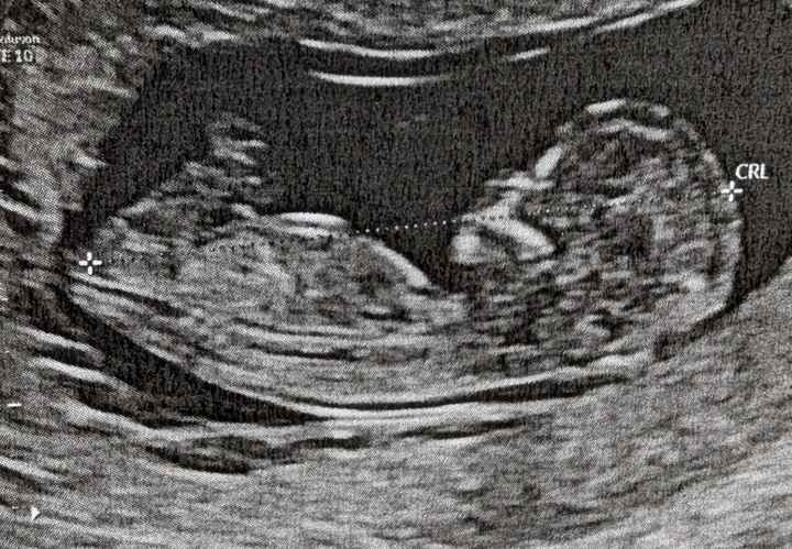 Nub theory, giochiamo un po’ - 1