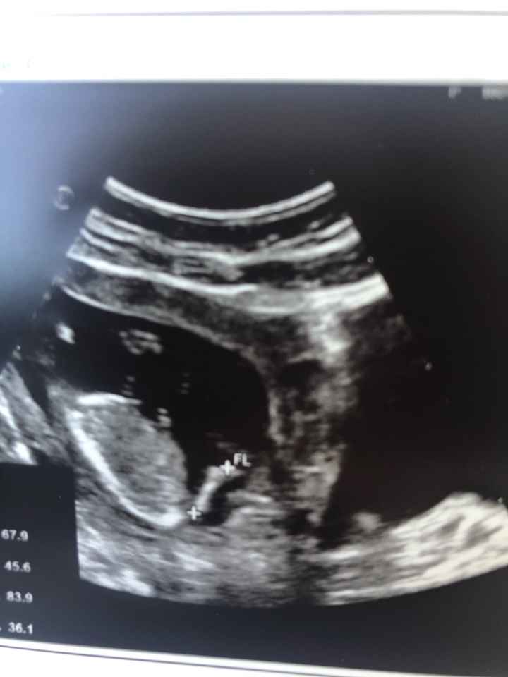 Nub theory. Maschio o femmina?💙🎀 - 1