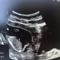 Nub theory. Maschio o femmina?💙🎀 - 1