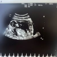 Nub theory. Maschio o femmina?💙🎀 - 2