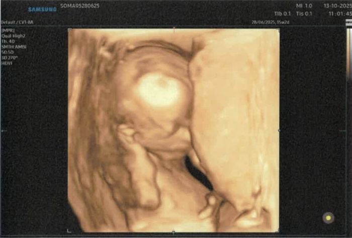 Future mamme febbraio/marzo/aprile 2026 🌸🌼🌿🌾 2