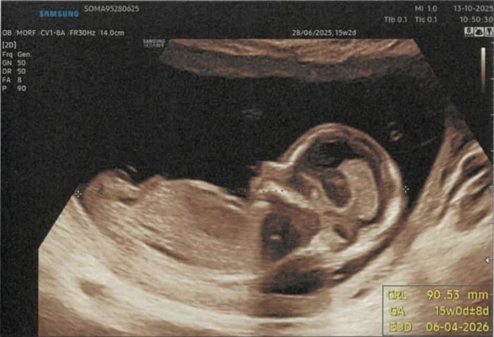 Future mamme febbraio/marzo/aprile 2026 🌸🌼🌿🌾 3