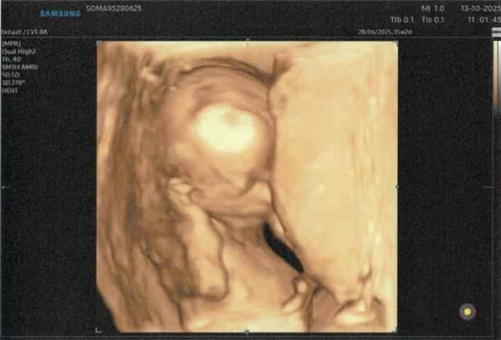 Future mamme febbraio/marzo/aprile 2026 🌸🌼🌿🌾 - 1