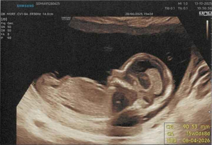 Future mamme febbraio/marzo/aprile 2026 🌸🌼🌿🌾 - 2