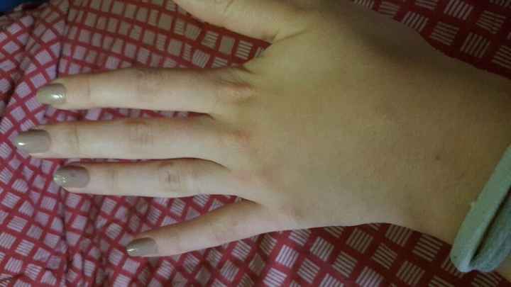 Anello di fidanzamento - 1