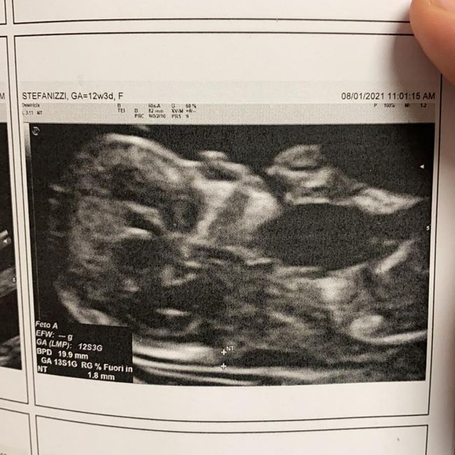 Future mamme Luglio 2021... - 1