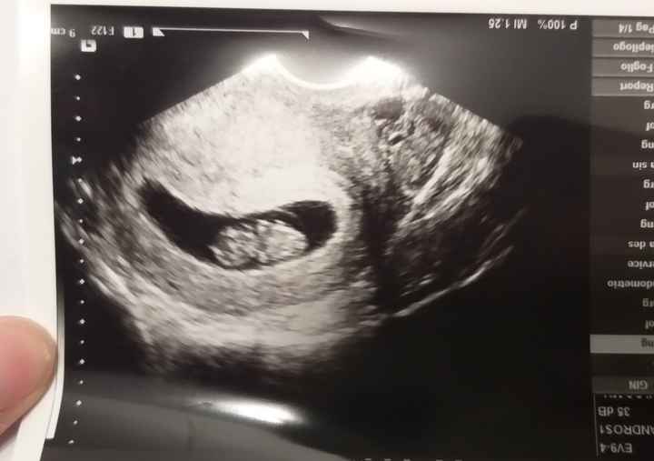 Future Mamme Settembre 2021😍 - 1