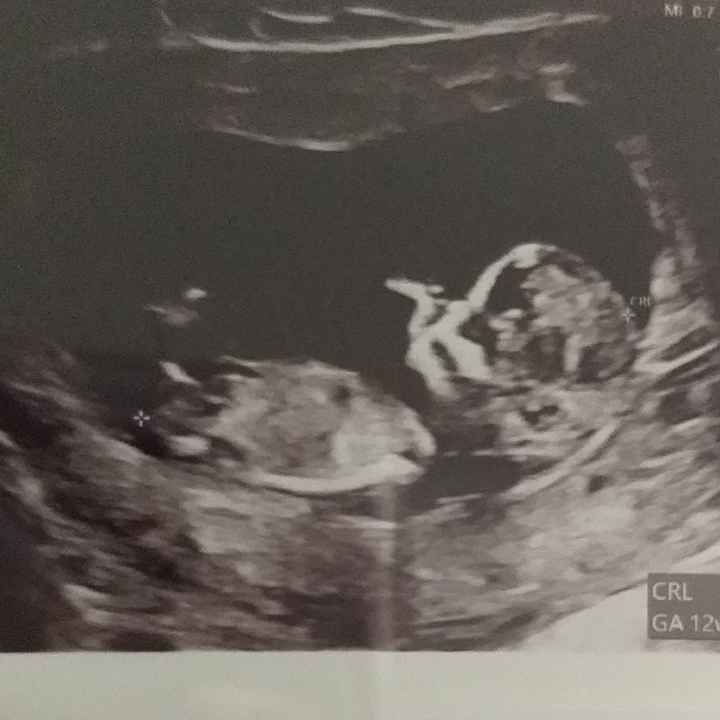 Future Mamme Settembre 2021😍 - 1