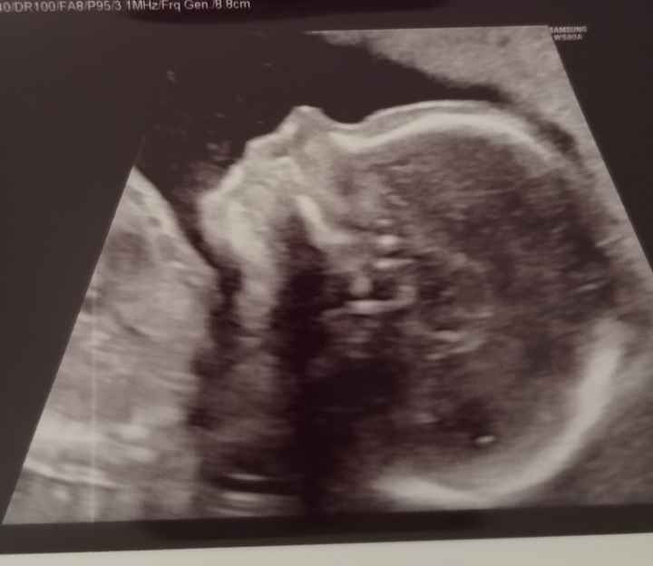 Future Mamme Settembre 2021😍 - 1