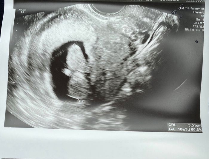 Future mamme novembre 2020 🌞🍁🌷♾ - 1