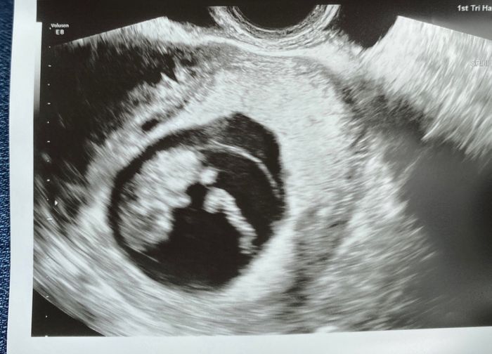 Future mamme novembre 2020 🌞🍁🌷♾ - 2