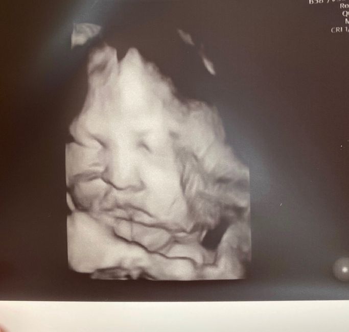 Future mamme novembre 2020 🌞🍁🌷♾ - 1