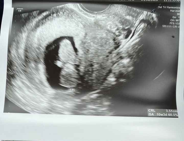 Future mamme novembre 2020 🌞🍁🌷♾ - 1